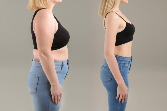 How Diet And Lifestyle Influence Results With Weight Loss Drugs